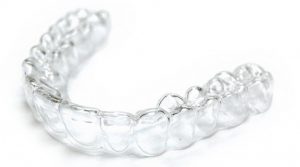 ortodoncia-transparente-ortodoncia-en-leon