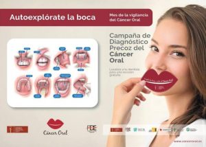 cartel-2018-deteccion-precoz-del-cancer-oral-leon