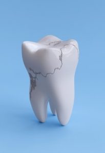 Urgencias dentales frecuentes Leon