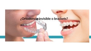 ortodoncia-invisible-o-brackets